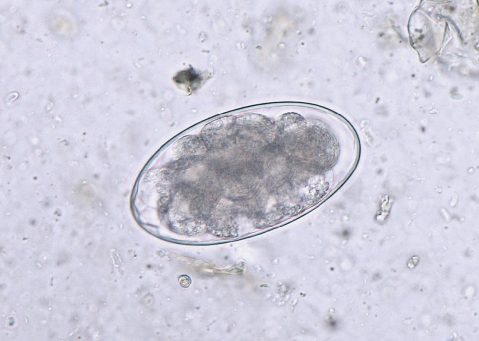 Paraziti přežvýkavců Chabertia ovina Vajíčka: 90 105 50 55 µm, obsahují 16 32 blastomer Dospělec: samec 13 14 mm, samice 17 20 mm, hlístice s velkým ústním otvorem Hostitel: ovce Prepatentní perioda: