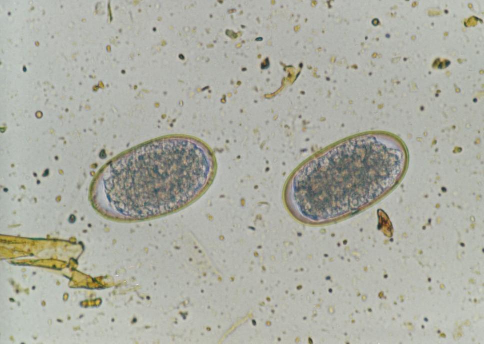 Paraziti přežvýkavců Ostertagia ostertagi Vajíčka: 90 120 30 42 µm, elipsoidní tvar, strongylidního typu, 16 32 blastomer Dospělec: samec 6 mm, samice 8 9 mm, štíhlí hlísti červenohnědé barvy s