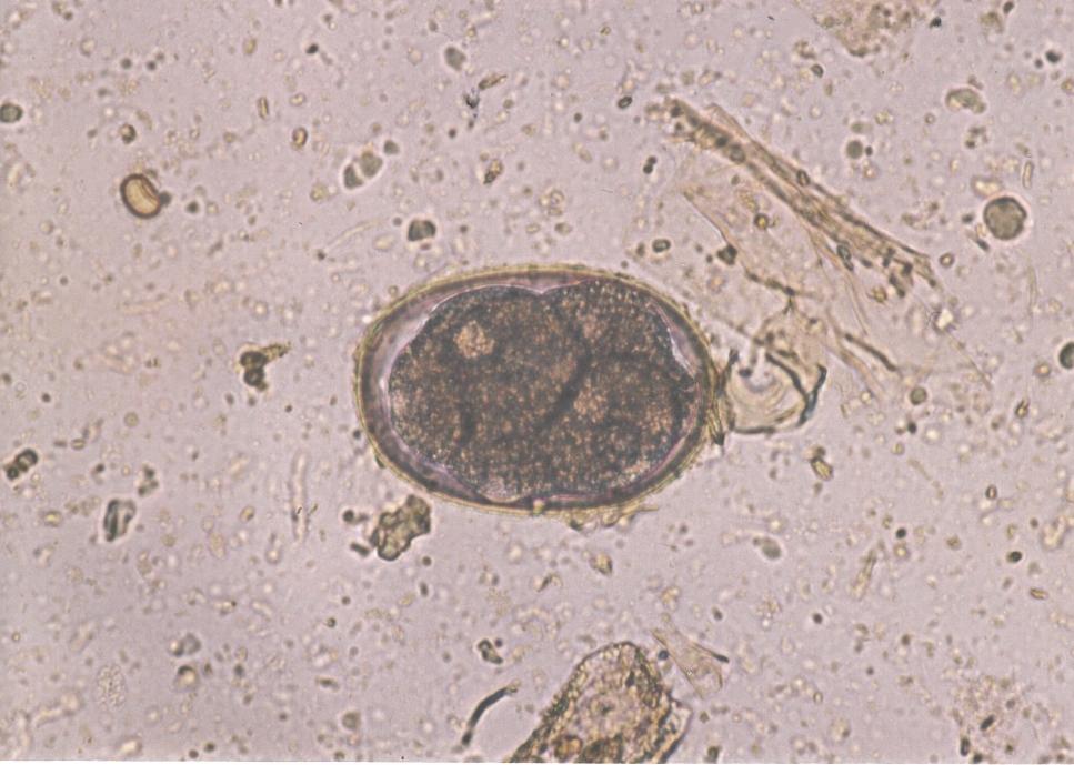Paraziti přežvýkavců Bunostomum phlebotomum Vajíčka: 88 104 47 56 µm, nepravidelně elipsovitého tvaru, 4 8 blastomer Dospělec: 1 3 cm, šedobílý s charakteristickými háčky Hostitel: ovce, kozy, skot,
