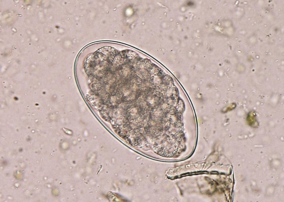 Paraziti přežvýkavců Marshallagia marshalli Vajíčka: 150 170 30 42 µm, oválný tvar, strongylidního typu, 16 32 blastomer Dospělec: samec 10 13 mm, samice 15 20 mm, štíhlí hlísti červenohnědé barvy s