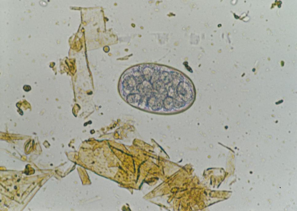 Paraziti přežvýkavců Haemonchus contortus Vajíčka: 88 104 47 56 µm, elipsovitého tvaru, blastomery vyplňují téměř celé vajíčko, jejich počet je obtížně rozlišitelný Dospělec: 2 3 cm, samec s
