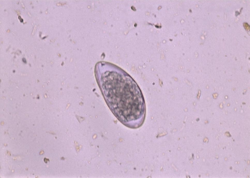 Paraziti přežvýkavců Trichostrongylus axei Vajíčka: 70 90 35 45 µm, podlouhle oválné, strongylidního typu, 16 32 blastomer Dospělec: samec 4,0 5,5 mm, samice 5,5 7,5 mm, malí, světle hnědočervení,