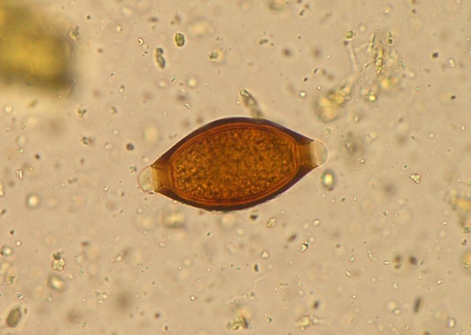 Paraziti přežvýkavců Trichuris ovis Vajíčka: 60 80 30 42 µm, citronovitý tvar s prominujícími zátkami na obou pólech, zárodečná buňka je chráněna silnostěnným tmavohnědým obalem Dospělec: samec 5 8
