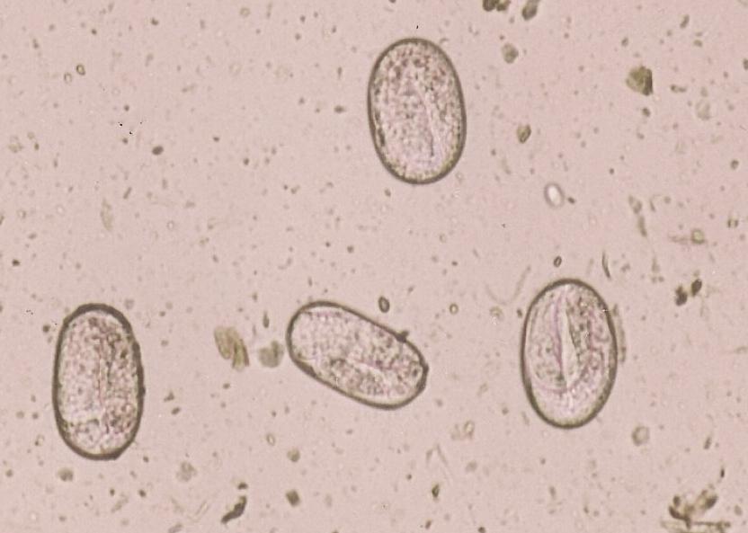 Paraziti přežvýkavců Strongyloides papillosus Vajíčka: 50 55 25 35 μm, tenkostěnná, obsahující larvu ve tvaru U Dospělec: velikost < 1 cm, velmi tenký vlasovitý nematod Hostitel: ovce, kozy, skot,