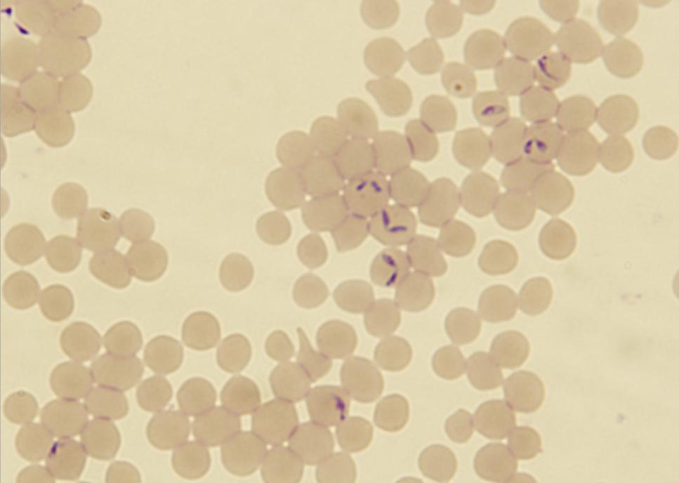 Paraziti přežvýkavců Babesia spp. Trofozoit: 1,5 4,5 0,4 2,0 µm v závislosti na druhu, obvykle přítomny v páru Definitivní hostitel: klíšťata Ixodes, Boophilus, Ripicephalus Mezihostitel: skot (B.