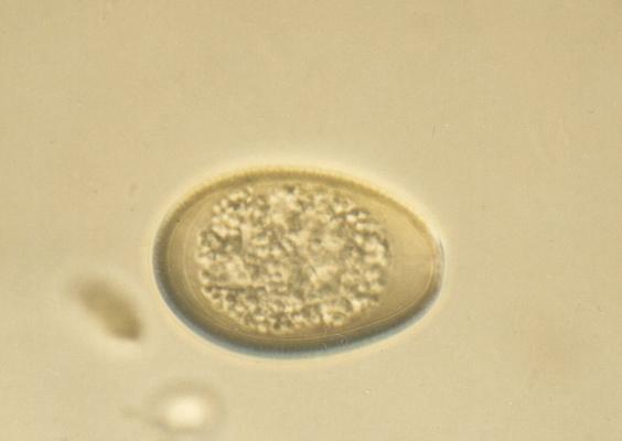 Paraziti přežvýkavců Hostitel: koza Eimeria christenseni: 38 25 µm, prepatentní perioda 14 23 dní Eimeria caprina: 32 23 µm, prepatentní perioda 17 20 dní Eimeria arloingi: 27 18 µm, prepatentní