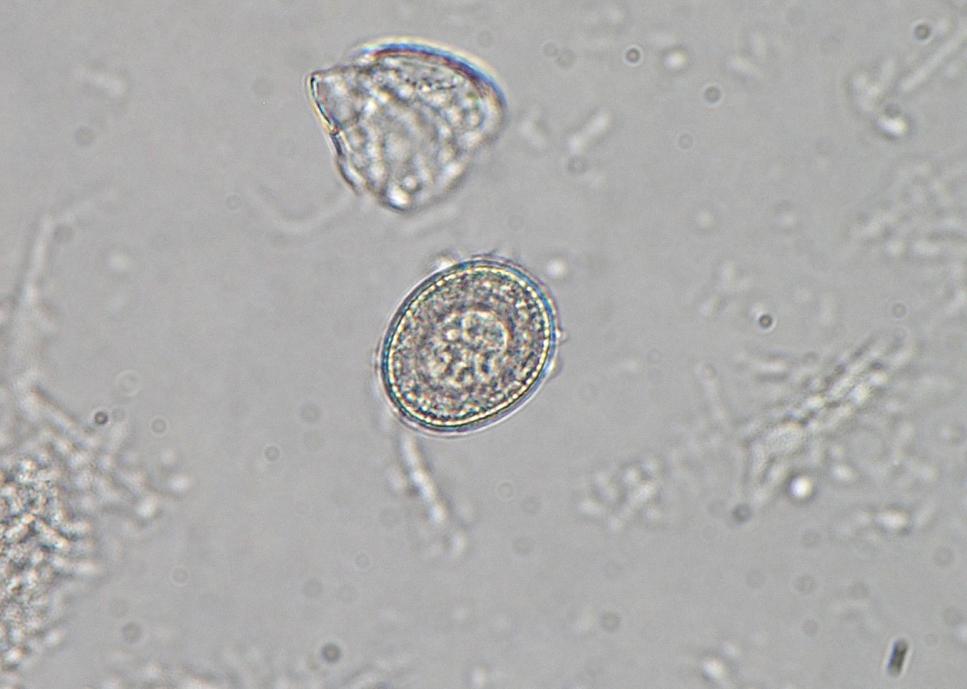Paraziti prasat Taenia solium Vajíčka: 31 43 µm, okrouhlého či oválného tvaru Dospělci: 2 4 m, skolex je kvadratický, o velikosti 1 mm, opatřen 4 přísavkami, na skolexu prominuje rostellum s dvěma