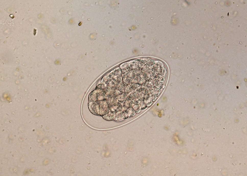 Paraziti prasat Oesophagostomum spp.