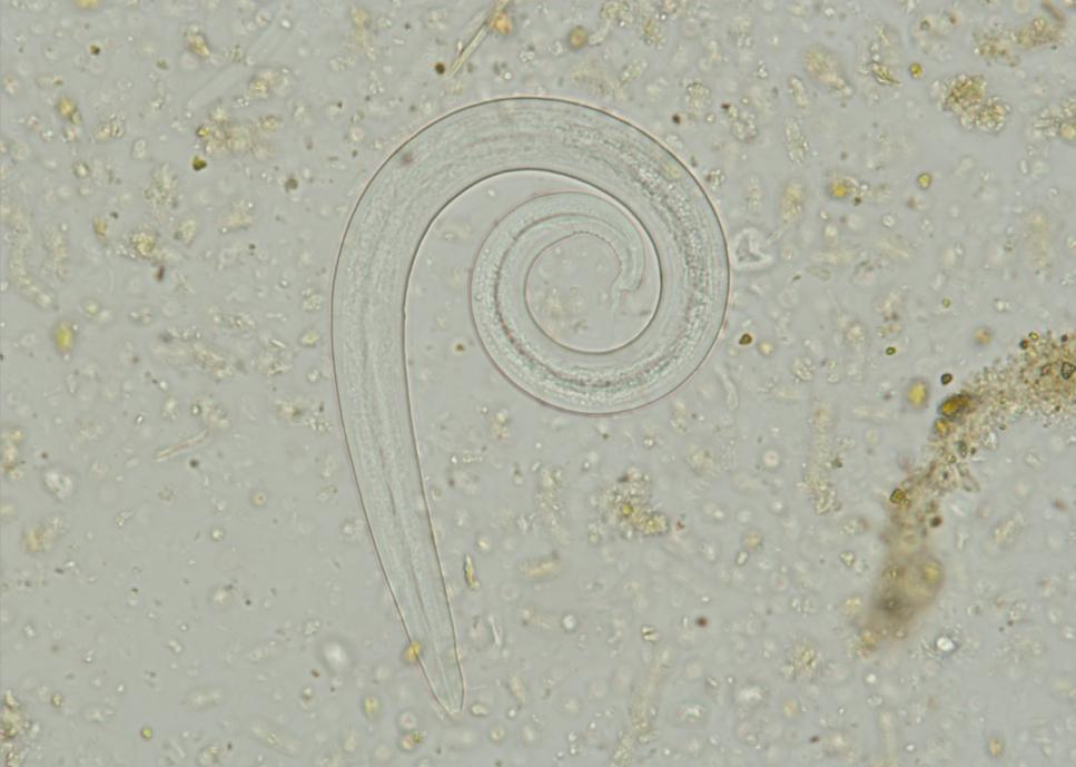 Paraziti prasat Metastrongylus elongatus Vajíčka: 45 57 38 41 µm, s hrubou silnou stěnou, obsahuje L1 larvu Dospělci: samec 25 mm, samice 58 mm, tencí bílí nematodi Definitivní hostitel: prase