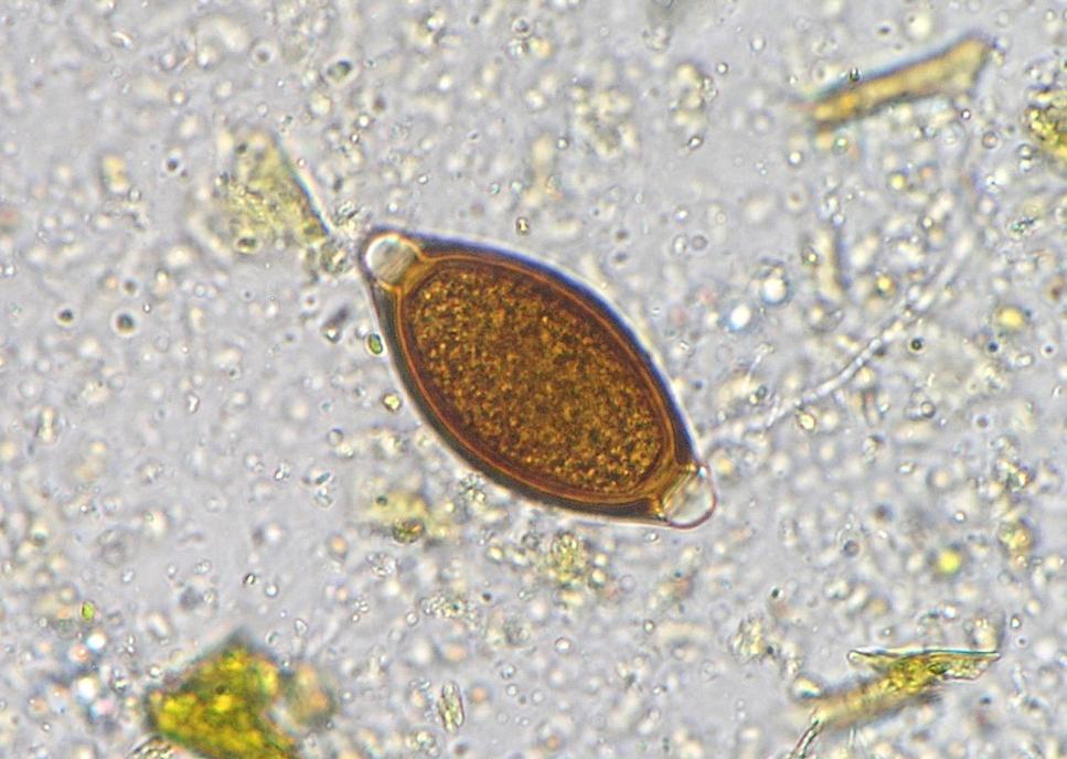 Paraziti prasat Trichuris suis Vajíčka: 60 25 µm, tenkostěnná, hnědé nebo žlutohnědé barvy, typického citrónovitého tvaru s dvěmi prominujícími pólovými zátkami Dospělci: 3 5 cm, bílé barvy, přední