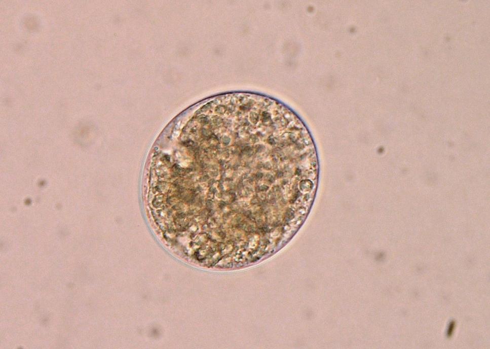 Paraziti prasat Neobalantidium coli Cysty: 40 60 µm, okrouhlého tvaru Trofozoiti: 50 150 µm Hostitel: prase reservoár, příležitostně člověk, pes Prepatentní perioda: 3 týdny Lokalizace: tlusté střevo