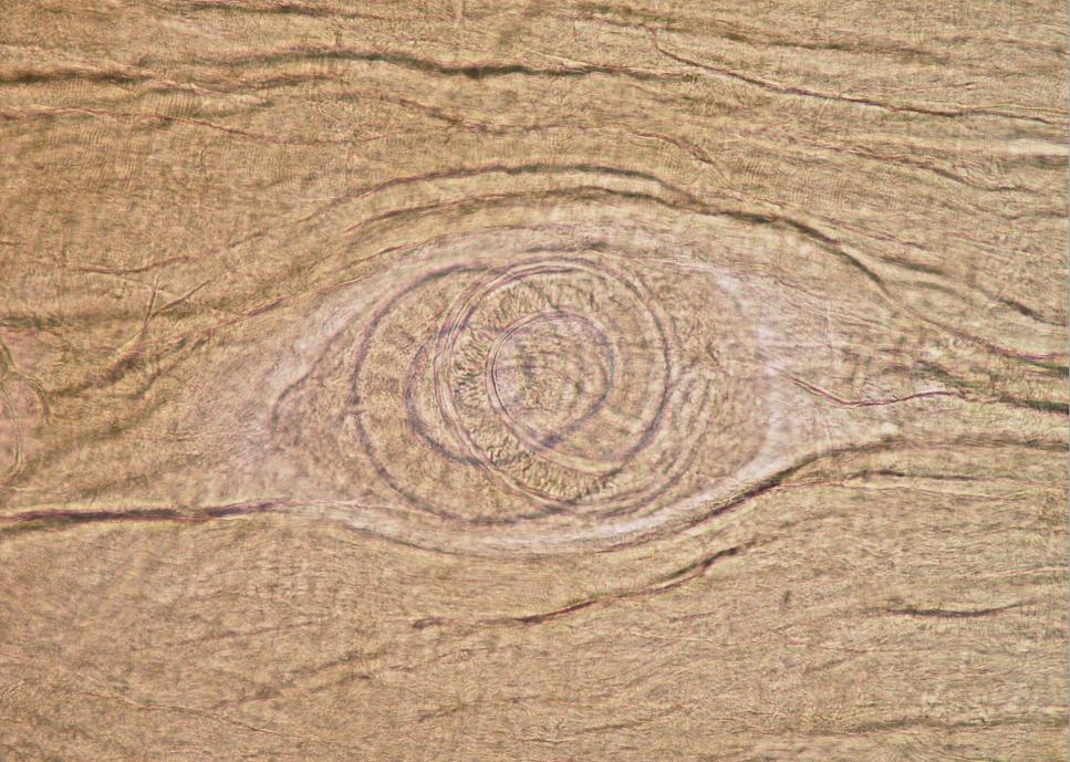 Paraziti prasat Trichinella spiralis Cysta: 0,3 0,8 0,2 0,4 mm, průhledná, citrónovitého tvaru Dospělci: samec 1,2 18 mm, má dva kloakální laloky, samice 1,3 4 mm, v děloze nese již živé larvy