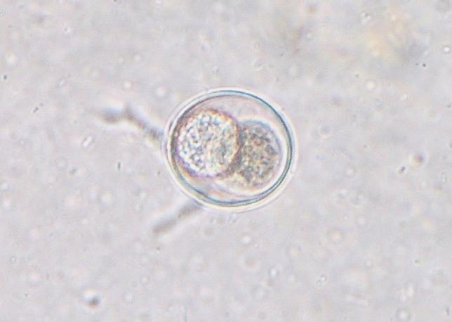 Paraziti prasat Isospora suis Oocysta: 19 24 17 21 µm, okrouhlá bez mikropyle, Hostitel: prase, nejčastěji selata ve věku 7 14 dní Prepatentní perioda: 7 10 dní Lokalizace: jejunum a ileum Klinické