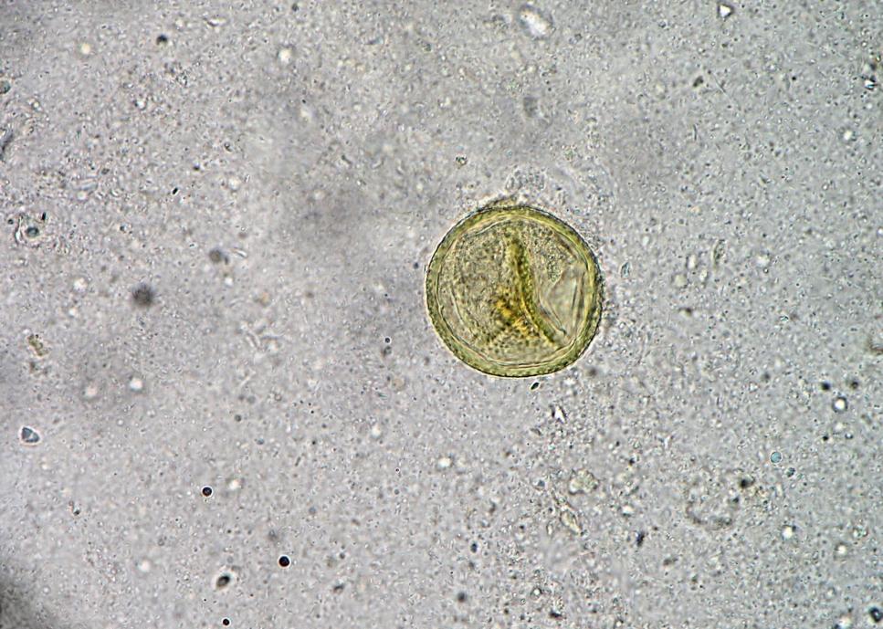 Paraziti šelem Taenia taeniaeformis Vajíčka: 50 μm v průměru, okrouhlá se silnou stěnou, obsahují hexakant Dospělec: 15 60 cm Definitivní hostitel: kočka Mezihostitel: hlodavci (typická lokalizace na