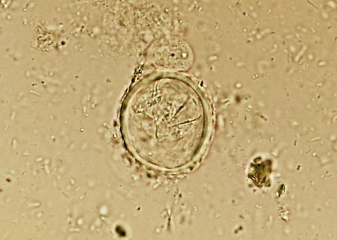 Paraziti šelem Multiceps multiceps Vajíčka: 38 32 μm v průměru, okrouhlá se silnou stěnou, obsahují embryo se šesti háčky Larvocysta: encystovaná larvální forma tasemnice (coenurus) skládající se z