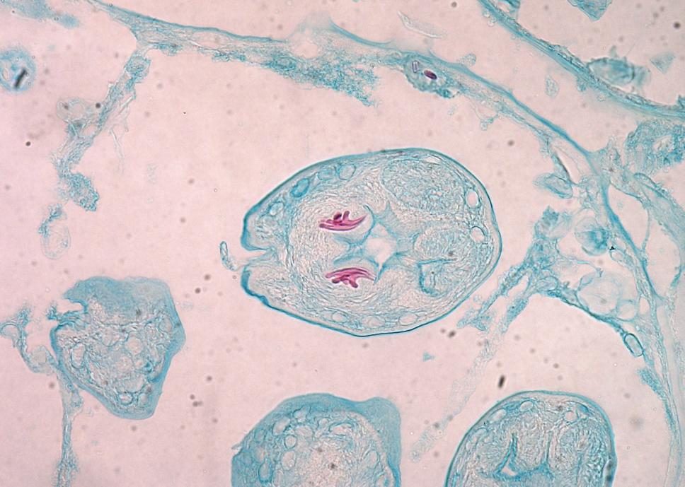 Paraziti šelem Echinococcus multilocularis Vajíčka: 32 36 30 40 μm, vajíčka podobné tasemnicím Taenia, okrouhlá se silnou stěnou, embryo se šesti háčky Dospělec: 2 5 mm Definitivní hostitel: liška,