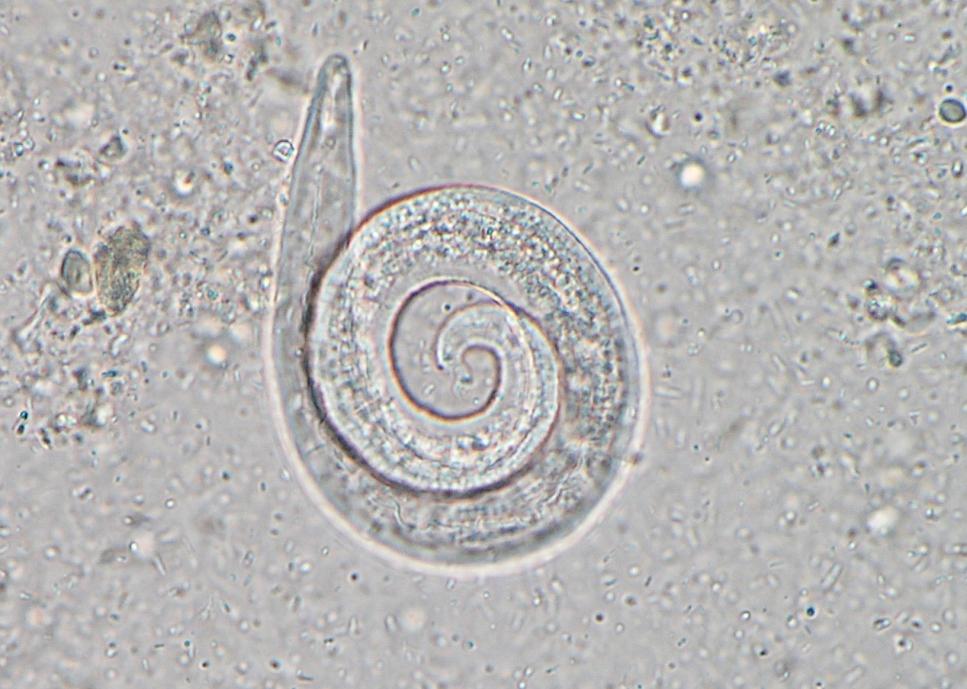 Paraziti šelem Strongyloides stercoralis Larva L1: 150 200 μm, uvnitř je patrný hltan a střevo Dospělec: 0,7 2,2 mm Hostitel: pes, primáti Prepatentní perioda: 1 týden Lokalizace: tenké střevo