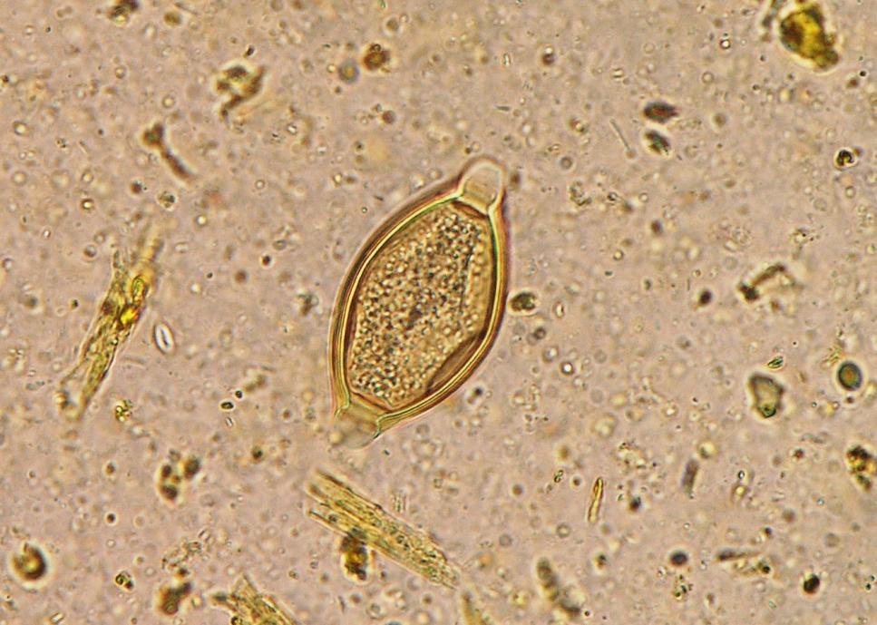 Paraziti šelem Trichuris vulpis Vajíčka: 75 90 32 40 μm, silnostěnná, citrónovitého tvaru s výraznými prominujícími zátkami na obou pólech, syté žlutohnědé barvy, jemně granulovaný nesegmentovaný