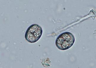 20 μm Oocysta Eimeria falciformis,
