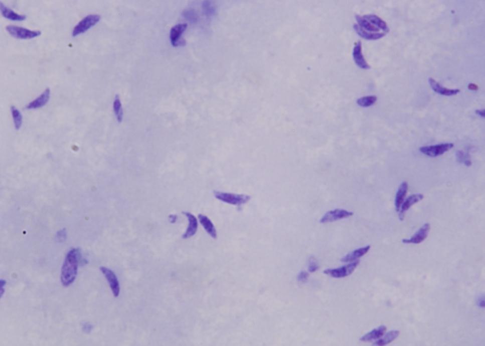 Zoonotické parazitózy Toxoplasma gondii Oocysty 11 13 µm, tenkostěnné, nevysporulované obsahující jeden sporont.