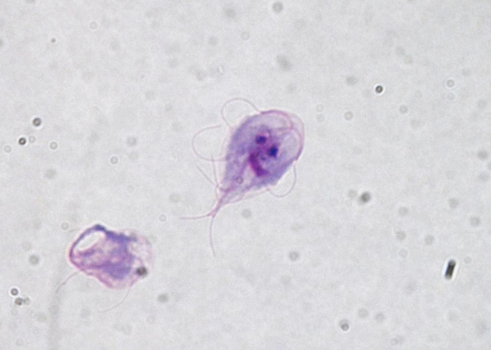 Zoonotické parazitózy Giardia spp.