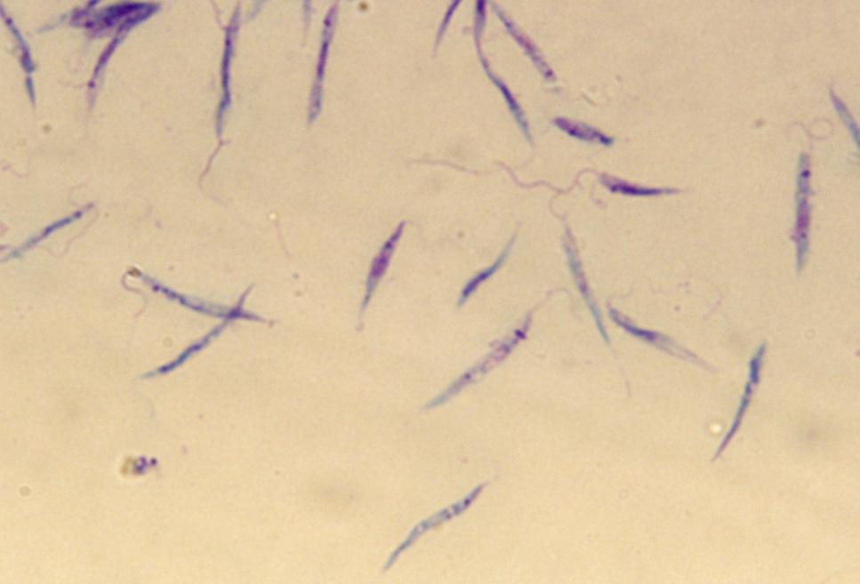 Zoonotické parazitózy Leishmania spp.