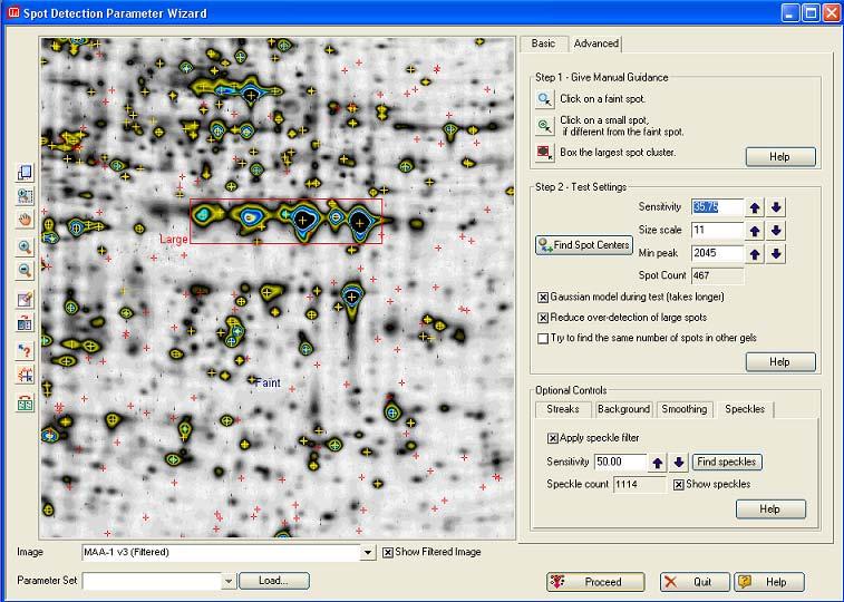 Vyhodnocování pomocí PDQuest Sejmutí obrazu Spot detection wizard průvodce nastavením parametrů pro vyhledání Úprava obrazu velikost,