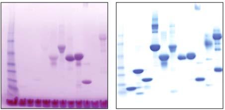 Detekce Typy detekce Značení před analýzou (DIGE CyDye, radioaktivní značení) Barvení po analýze Nespecifické barvení: všechny proteiny Viditelné barvení: Coomassie brilliant blue (R250, G250),