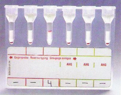 Tab. 4 Přehled celkem vyšetřených a pozitivních screeningů protilátek na Transfuzním oddělení Havlíčkův Brod za období 2000 2009 Rok