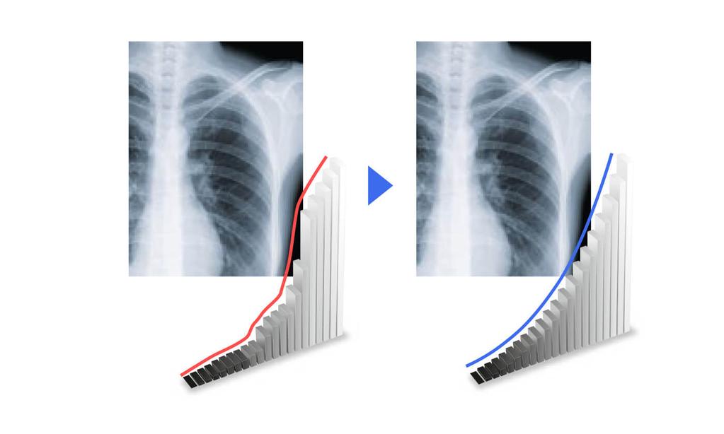 Výsledkem je velmi konzistentní odstupňování odstínů šedé, jež umožňuje optimální radiologickou diagnostiku.