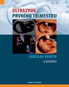 cz/kniha/ultrazvukprvniho-trimestru DOPORUČENÁ ULTRAZVUKOVÁ VYŠETŘENÍ V TĚHOTENSTVÍ autorského kolektivu Marek Ľubušký Ladislav Krofta Lubomír Hašlík Ivana Marková Marek Ľubušký, Ladislav