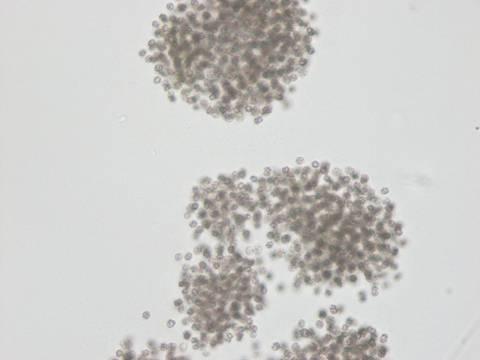 Microcystis