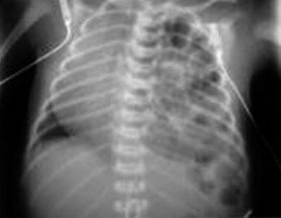 SPECIFICKÉ SITUACE S NUTNOSTÍ RESUSCITACE NA PORODNÍM SÁLE 14. Specifické situace s nutností resuscitace na porodním sále 14.