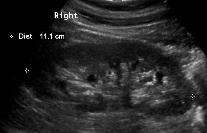 Anatomie rozměry: - délka 10-11cm -