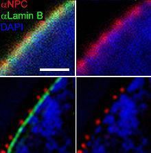 S I M (Structured Illumination Microscopy) 1 µm Detail jaderné membrány: červeně jaderné póry (anti-npc) zeleně jaderný obal (anti-lamin)