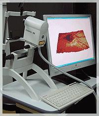 Vyšetření glaukomu 34 K získání obrazů zadního segmentu oka slouží monochromatické koherentní záření, jehož zdrojem je diodový laser o vlnové délce 670 nm.