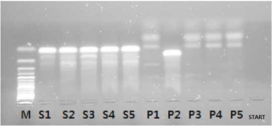 4 VÝSLEDKY 4.1 Vyhodnocení agarózového gelu Výsledek gelové elektroforézy je znázorněn na obrázku č. 8. Agarózový gel obsahuje celkem 11 drah se vzorky.