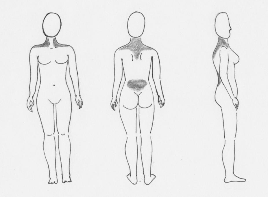 5.2 Výsledky výzkumu a zhodnocení Shrnutí lokalizace bolesti Pro zaznamenání lokalizace bolesti byl využit názorný obrázek (Obrázek 1). Lokalizace bolestí testované a kontrolní skupiny byly obdobné.