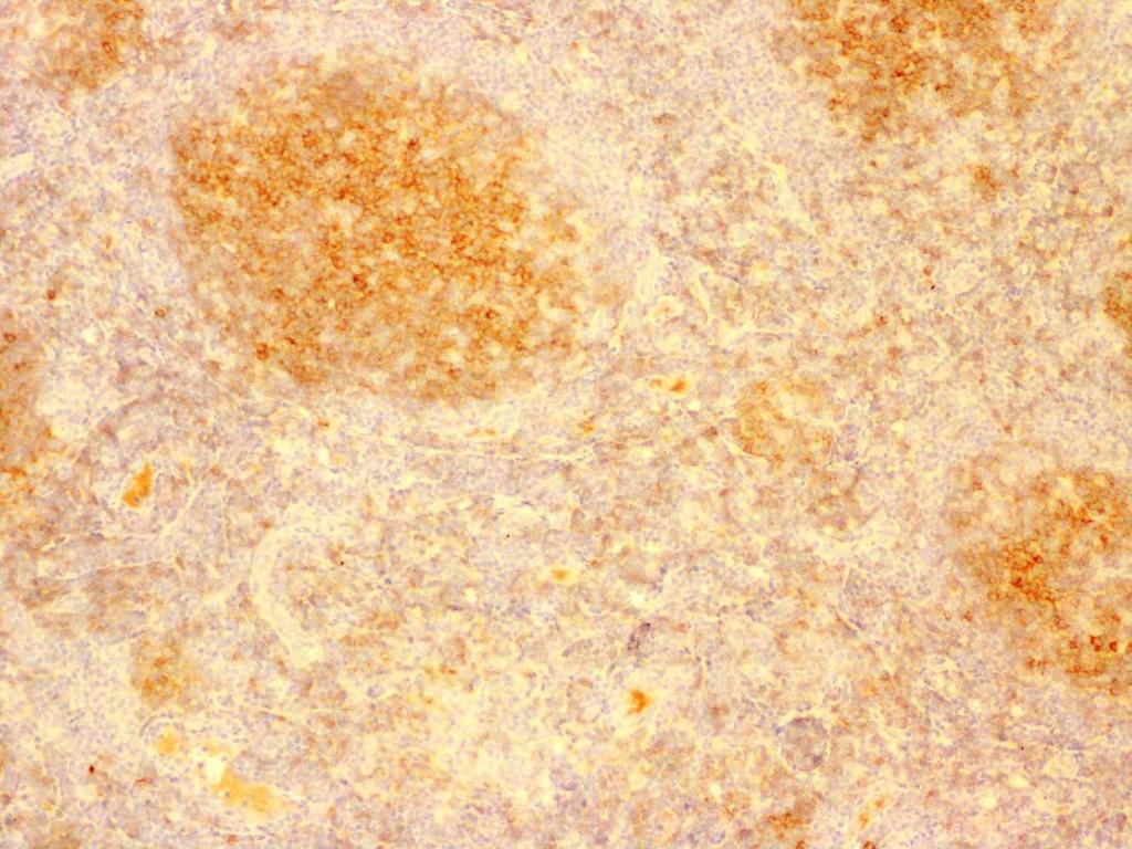 CD10 10x