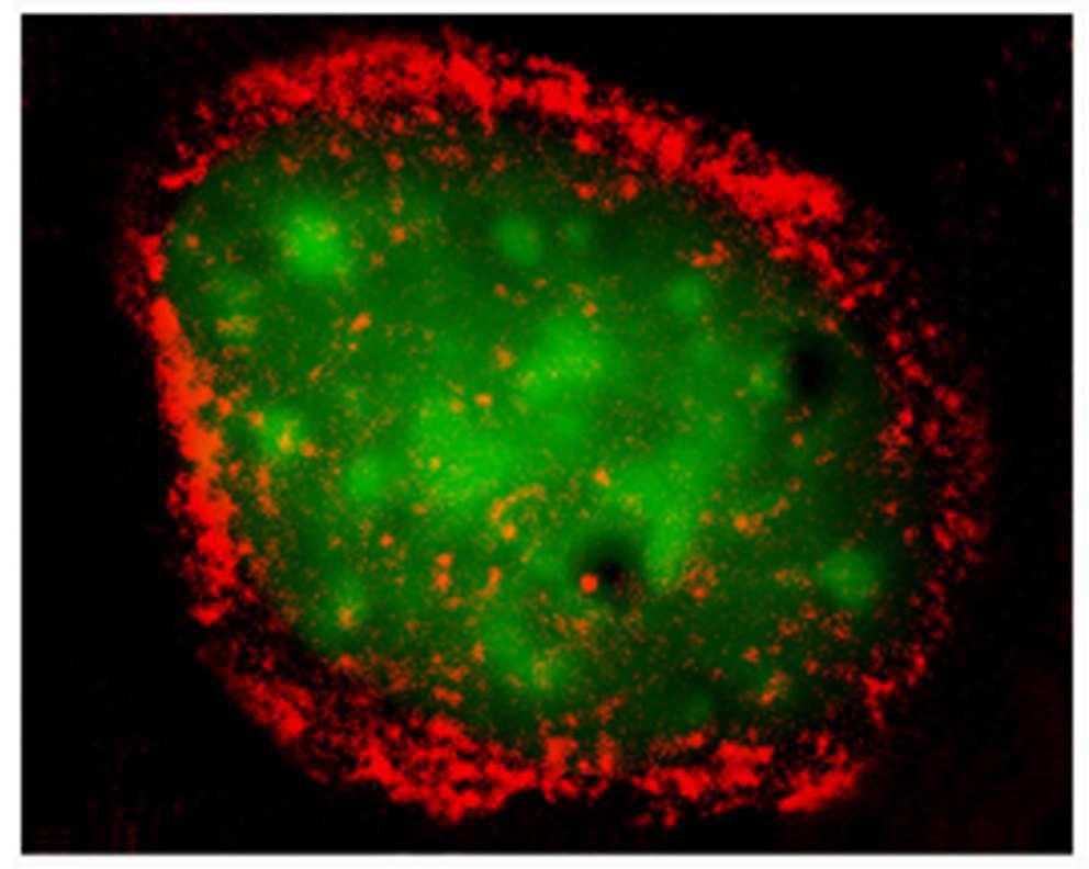 Nuclear lamina and lamins A-type lamins LMNA gene (A, A 10, C, C2) (in differentiated cells, tissue