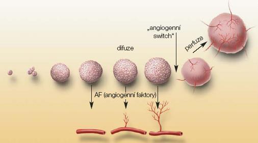 (hypoxii vyvolávající faktor). Tato změna se označuje jako tzv. angiogenní switch (Obr.