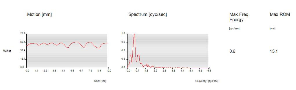 3.1.11.3 Maximální frekvenční energie zápěstí a maximální aktivní ROM Obrázek 25