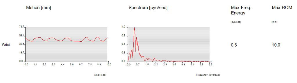 Maximální frekvenční energie všech prstů je 0,4 cyc/sec a maximální rozsah pohybu během cyklu flexe a extenze je u palce 2 mm, u ukazováku 10,4 mm, u prostředníčku 9,9 mm, u prsteníku