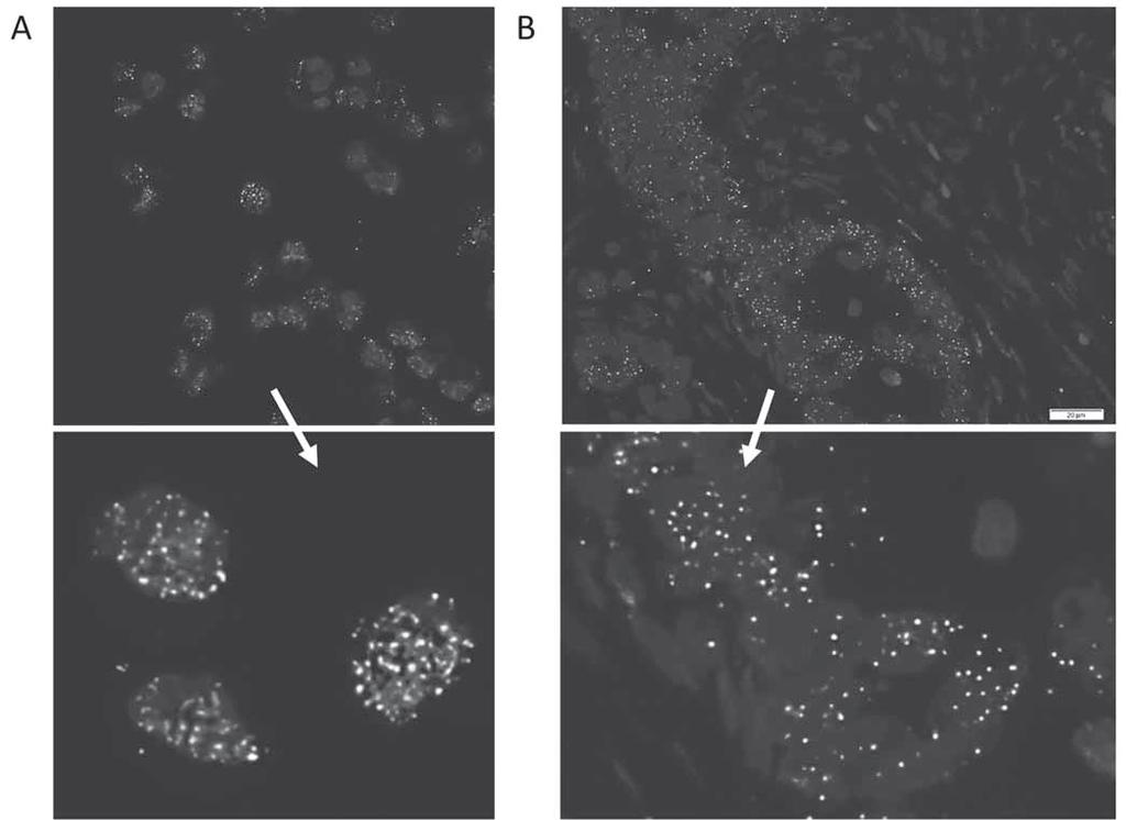 VYUŽITÍ METODY PLA PRO DETEKCI KOMPLEXŮ P53/ P63/ P73 IN SITU V NÁDOROVÝCH BUŇKÁCH A NÁDOROVÉ TKÁNI Obr. 2. Detekce proteinových komplexů pomocí PLA. A. Detekce komplexu p53 T antigen v buňkách SVK4 (originální zvětšení 400 ).