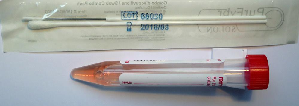 Urogenitální trakt průkaz DNA HSV-2 metodou PCR puchýřky, eroze Odběr z puchýřků: Protrhnout puchýřek sterilní jehlou (kopíčkem).