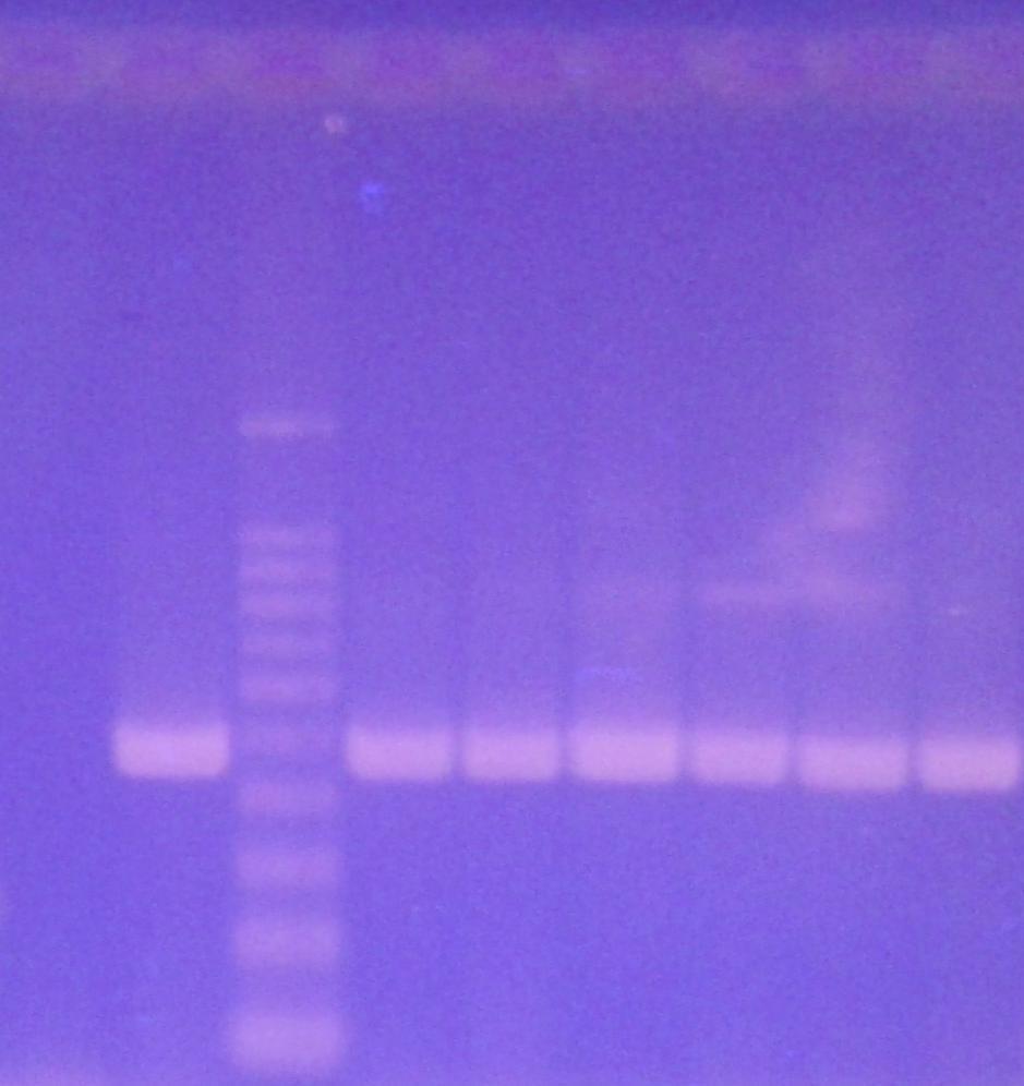 Tabulka 10: Schéma nanesení vzorků na gel pro doménu Bacteria s vyhodnocením intenzity produktů PCR.