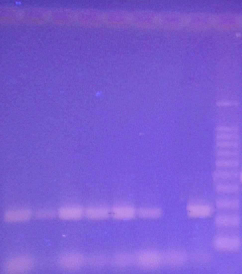 5.3 Důkaz přítomnosti DNA bakterií rodu Lactobacillus pomocí konvenční PCR Tabulka 11: Schéma nanesení vzorků na gel pro rod Lactobacillus s vyhodnocením intenzity produktů PCR.