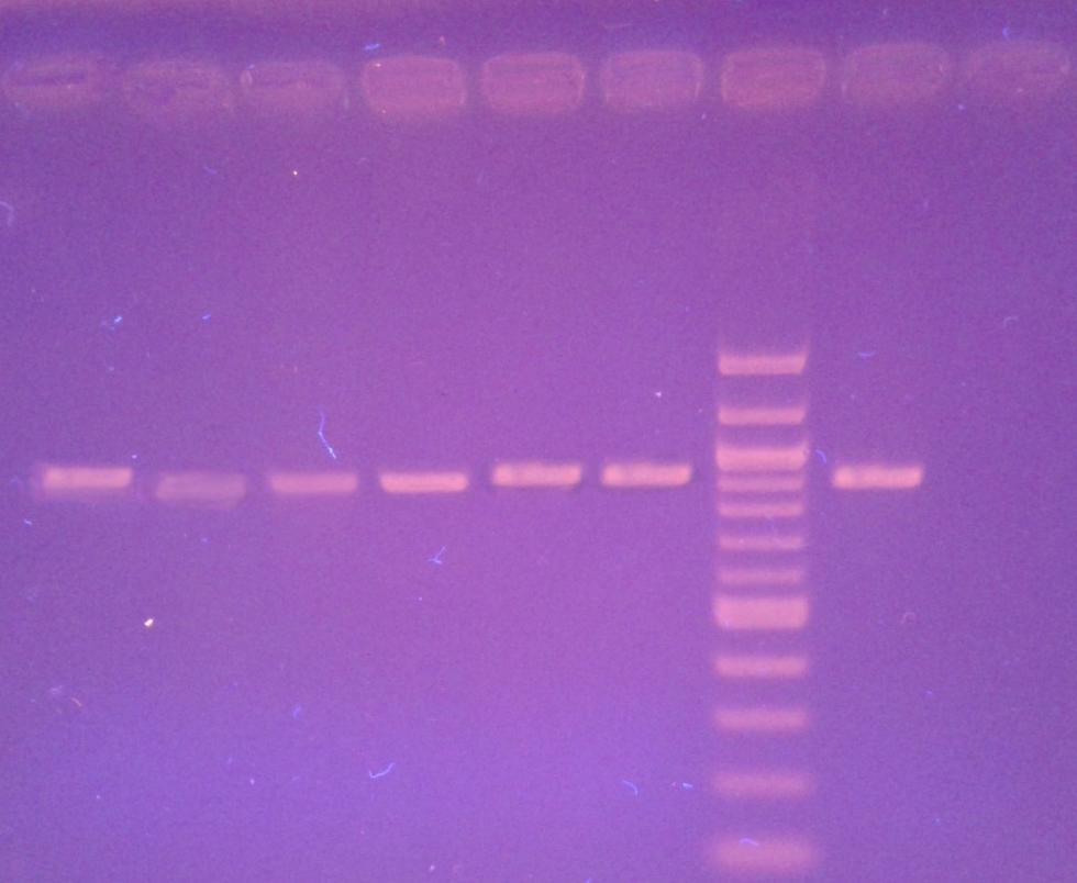 1 2 3 4 5 6 7 8 9 1500 bp 914 bp 900 bp 500 bp 100 bp Obrázek 8: Gelová elektroforéza produktů PCR specifických pro rod Bifidobacterium 5.