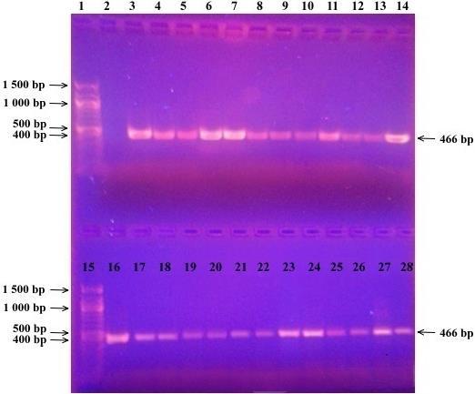 4.3.5 Konvenční PCR Všechny vzorky izolované DNA (metodou fenolové extrakce a magnetické separace) zředěné na 10 ng/µl byly podrobeny amplifikaci pomocí specifických PCR (dle bodu 4.2.10).