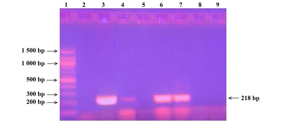 Značení křivek: červená pozitivní kontrola (DNA Lactobacillus pentosus CCM 4619), černá negativní kontrola, modré DNA izolovaná magnetickými nosiči Fkol B 100 ox, zelené DNA izolovaná magnetickými